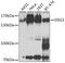 Desmoglein 1 antibody, GTX64482, GeneTex, Western Blot image 