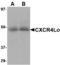 C-X-C Motif Chemokine Receptor 4 antibody, TA306518, Origene, Western Blot image 