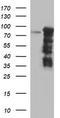 Forkhead Box P1 antibody, TA506702AM, Origene, Western Blot image 
