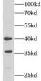 Phosphoserine aminotransferase antibody, FNab06846, FineTest, Western Blot image 