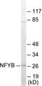 Nuclear Transcription Factor Y Subunit Beta antibody, EKC1697, Boster Biological Technology, Western Blot image 