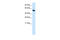 INSM Transcriptional Repressor 1 antibody, 27-664, ProSci, Western Blot image 