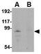 Junctophilin 4 antibody, GTX85362, GeneTex, Western Blot image 
