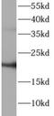 ATP Synthase Peripheral Stalk Subunit D antibody, FNab10033, FineTest, Western Blot image 