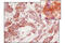 Eukaryotic Translation Initiation Factor 2 Alpha Kinase 3 antibody, 5683T, Cell Signaling Technology, Immunohistochemistry paraffin image 
