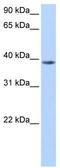 Nudix Hydrolase 13 antibody, TA346779, Origene, Western Blot image 
