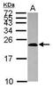 Deoxyuridine 5 -triphosphate nucleotidohydrolase antibody, PA5-30955, Invitrogen Antibodies, Western Blot image 