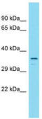 Coiled-Coil Domain Containing 189 antibody, TA334141, Origene, Western Blot image 