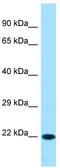 Hippocalcin-like protein 1 antibody, TA337287, Origene, Western Blot image 