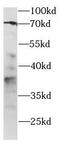 hPD-1 antibody, FNab06234, FineTest, Western Blot image 