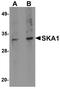 Spindle And Kinetochore Associated Complex Subunit 1 antibody, A06734, Boster Biological Technology, Western Blot image 