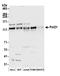 DNA polymerase delta catalytic subunit antibody, A304-007A, Bethyl Labs, Western Blot image 