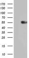 Interleukin 15 Receptor Subunit Alpha antibody, TA812233, Origene, Western Blot image 