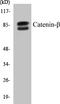 Catenin Beta 1 antibody, EKC1091, Boster Biological Technology, Western Blot image 