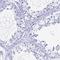 Leucine Zipper Protein 4 antibody, NBP2-33634, Novus Biologicals, Immunohistochemistry paraffin image 