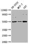 Immunoglobulin Heavy Constant Mu antibody, CSB-PA360788LA01HU, Cusabio, Western Blot image 