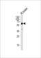 Glutamate Decarboxylase 2 antibody, LS-C166333, Lifespan Biosciences, Western Blot image 
