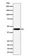 BTB/POZ domain-containing protein KCTD9 antibody, M12515-1, Boster Biological Technology, Western Blot image 