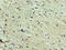 DnaJ Heat Shock Protein Family (Hsp40) Member C30 antibody, LS-C371830, Lifespan Biosciences, Immunohistochemistry paraffin image 