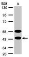 Calcium-binding and spermatid-specific protein 1 antibody, PA5-28518, Invitrogen Antibodies, Western Blot image 