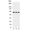 Cholesterol 7-alpha-monooxygenase antibody, R31040, NSJ Bioreagents, Western Blot image 