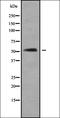 Aquaporin-10 antibody, orb338017, Biorbyt, Western Blot image 