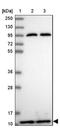 Prefoldin Subunit 6 antibody, NBP2-47335, Novus Biologicals, Western Blot image 