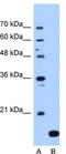 N(Alpha)-Acetyltransferase 50, NatE Catalytic Subunit antibody, TA346839, Origene, Western Blot image 