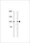 Ribosomal Protein S6 Kinase A3 antibody, 63-300, ProSci, Western Blot image 