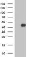 3-ketoacyl-CoA thiolase, mitochondrial antibody, TA506200, Origene, Western Blot image 