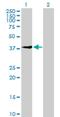 UEV And Lactate/Malate Dehyrogenase Domains antibody, H00055293-B01P, Novus Biologicals, Western Blot image 
