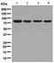 p84N5 antibody, ab131268, Abcam, Western Blot image 