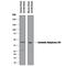Carbonic anhydrase 14 antibody, AF2195, R&D Systems, Western Blot image 