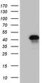 Zinc Finger Protein 558 antibody, M16640, Boster Biological Technology, Western Blot image 