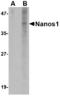 Nanos C2HC-Type Zinc Finger 1 antibody, LS-C53328, Lifespan Biosciences, Western Blot image 