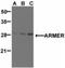 ADP Ribosylation Factor Like GTPase 6 Interacting Protein 1 antibody, NBP1-77198, Novus Biologicals, Western Blot image 