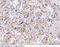 Galectin 1 antibody, 10290-MM01, Sino Biological, Immunohistochemistry paraffin image 
