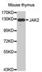 Janus Kinase 2 antibody, abx000693, Abbexa, Western Blot image 