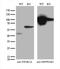 Phosphatidylinositol-5-Phosphate 4-Kinase Type 2 Alpha antibody, M04244-1, Boster Biological Technology, Western Blot image 