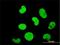 Zinc Finger Protein 207 antibody, H00007756-M03, Novus Biologicals, Immunocytochemistry image 