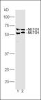 Neuropilin And Tolloid Like 1 antibody, orb2976, Biorbyt, Western Blot image 