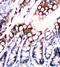 Fatty Acid Binding Protein 5 antibody, PA5-79234, Invitrogen Antibodies, Immunohistochemistry paraffin image 