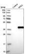 Monoglyceride Lipase antibody, HPA011994, Atlas Antibodies, Western Blot image 