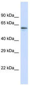 Zinc Finger Protein 527 antibody, TA345357, Origene, Western Blot image 