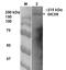 Dicer 1, Ribonuclease III antibody, NBP2-22415, Novus Biologicals, Western Blot image 