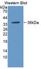 Carboxypeptidase N subunit 2 antibody, LS-C374850, Lifespan Biosciences, Western Blot image 