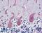 Suppression of tumorigenicity 18 protein antibody, LS-B3507, Lifespan Biosciences, Immunohistochemistry paraffin image 