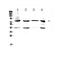 Hydroxysteroid 17-Beta Dehydrogenase 4 antibody, GTX12084, GeneTex, Western Blot image 