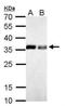 Pyrophosphatase (Inorganic) 1 antibody, NBP1-31348, Novus Biologicals, Western Blot image 
