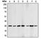 BCL2 antibody, LS-C351903, Lifespan Biosciences, Western Blot image 